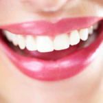 4-astuces-naturelles-pour-avoir-les-dents-blanches_width1024