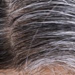 white-and-gray-hairs-growing-on-person-s-head